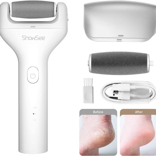 Showsee B1 Callus Remover