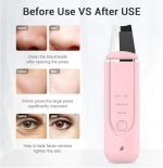 Xiaomi InFace Ultrasonic Ion Cleansing Instrument